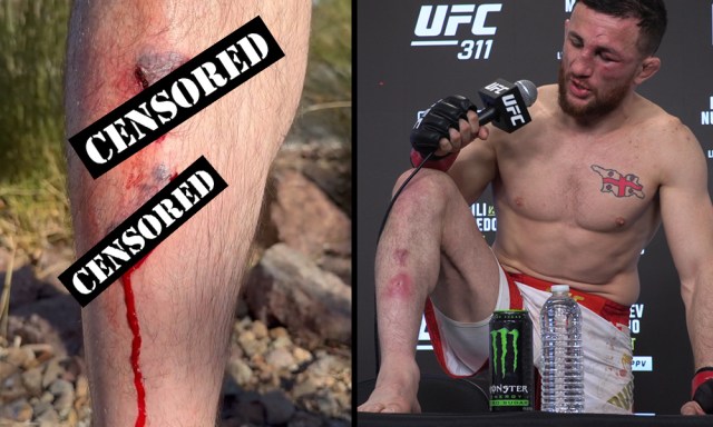 Merab Dvalishvili shares graphic footage of pre-#UFC311 injury he hid from commission