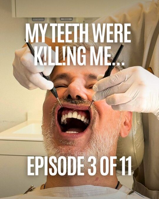 I just had a TON of toxic dental materials removed… and I’m speechless. Most of us have no idea that our dental work c…